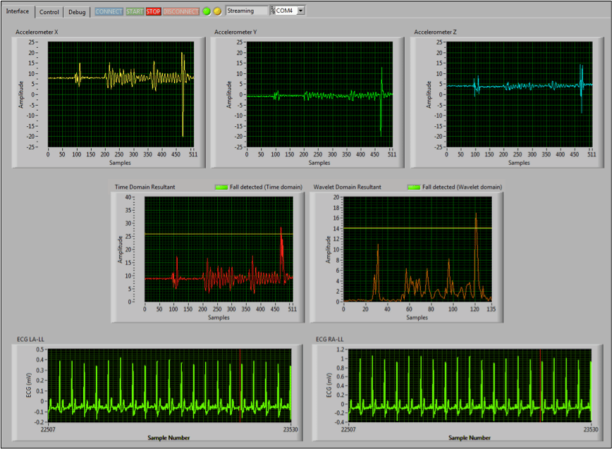 Fall Detection and Multi-resolution analysis using Shimmer