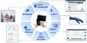 Wearables in Digital Therapeutics for Treating Musculoskeletal Conditions
