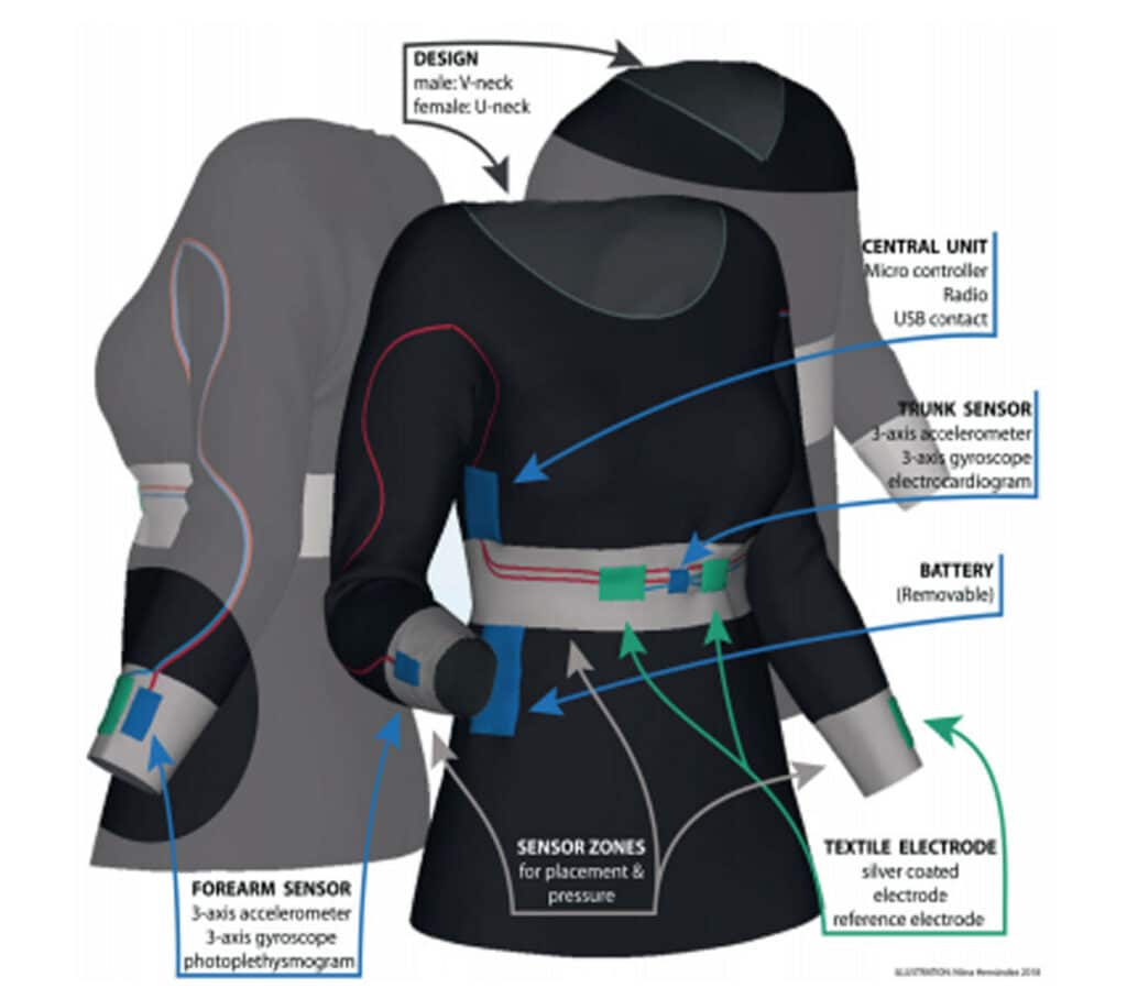 Using Shimmer3 Imu To Monitor Epilepsy And Parkinson S Disease Using Shimmer3 Imu To Monitor Epilepsy And Parkinson S Disease