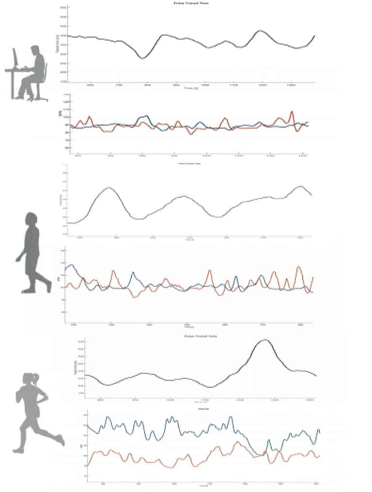 wearable IMU sensor for parkinson's and epilepsy